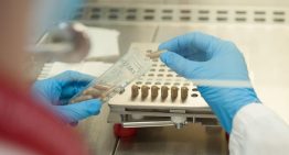 Identificados metabolitos vinculados a la microbiota intestinal que podrían ayudar a detectar la demencia años antes