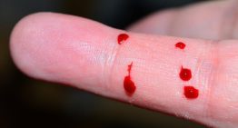 Llega a España concizumab, la primera terapia para todos los tipos de hemofilia que padecen 3.000 españoles