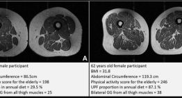 Las dietas altas en alimentos ultraprocesados también alteran la salud muscular