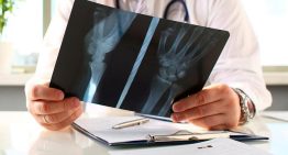 ¿Sabías que tus huesos están vivos y se renuevan constantemente? Descubre los secretos de tu esqueleto