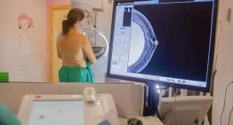Sanidad amplía el cribado de cáncer de mama a mujeres jóvenes y mayores, el nuevo rango es entre 45 y 74 años