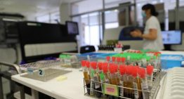 Los Comuns reclaman un plan de ciudad para mejorar la prevención del VIH en Barcelona