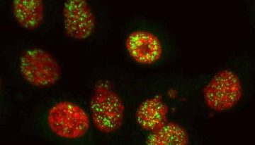 El Hospital del Mar identifica una nueva estrategia contra el cáncer de páncreas que ataca las células tumorales y activa el sistema inmunitario