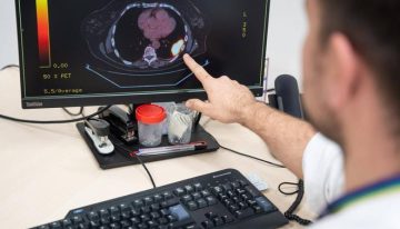 Un estudio apunta a que la vitamina D ayuda a la recuperación de los pacientes tras un ictus