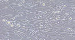Un estudio identifica el 'escudo' que utiliza un cáncer de hígado muy agresivo para resistir la quimioterapia