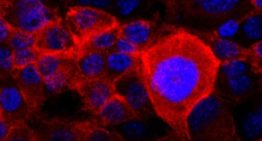 EEUU aprueba Rasonque, una píldora que duplica la supervivencia de pacientes con la forma más común de cáncer de páncreas