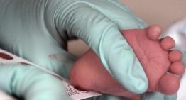 El cribado neonatal de Catalunya detecta al primer bebé con adrenoleucodistrofia, una grave enfermedad neurológica
