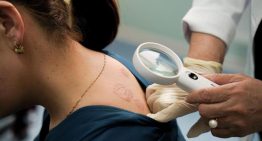 El 79% de los dermatólogos ejerce en áreas urbanas dejando a las poblaciones rurales «completamente desatendidas»