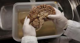 Del cerebro a la médula ósea: la nueva pista que investiga el papel del sistema inmune en el alzhéimer