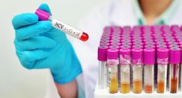 La infección por hepatitis C es cuatro veces más frecuente en personas con trastorno mental grave: «Hay que facilitar el acceso al cribado»