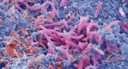 Identifican dos proteínas esenciales para proteger el intestino frente a infecciones graves
