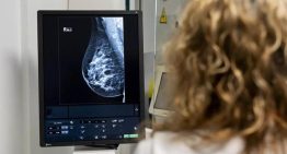 Un estudio analiza las variaciones genéticas de pacientes con cáncer de mama con más riesgo de desarrollar un grave efecto secundario por un fármaco