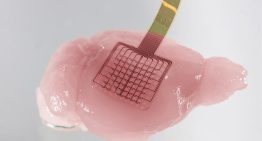 Una tecnología basada en grafeno monitoriza el cerebro para entender qué sucede tras un ictus y mejorar el tratamiento