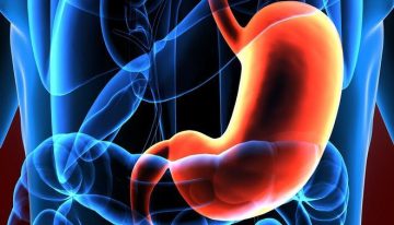 Cáncer de estómago: un tumor asintomático que tiene relación con el helicobácter pylori