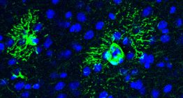 El Alzheimer comienza mucho antes que sus síntomas. Y hemos descubierto uno de sus primeros mecanismos