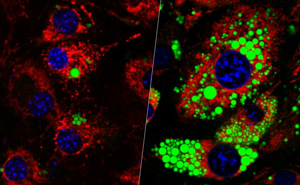 Perder peso sin perder músculo es el gran reto de fármacos como Ozempic. Una proteína guarda la clave para afrontarlo