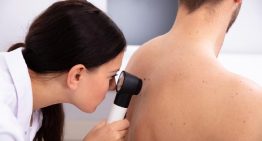 El cáncer de piel no deja de crecer en España: en 2025 se diagnosticarán más de 4.300 melanomas, el tumor más agresivo