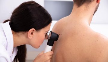 El cáncer de piel no deja de crecer en España: en 2025 se diagnosticarán más de 4.300 melanomas, el tumor más agresivo
