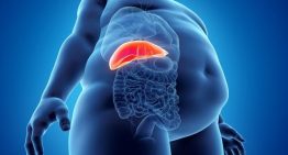 El 80% de jóvenes con sobrepeso padecen hígado graso, enfermedad que puede producir cirrosis o cáncer