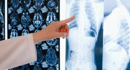 Las muertes por cáncer de pulmón en mujeres superan a las provocadas por tumores en la mama por primera vez en España