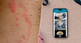 Una picadura de medusa arruinó mis vacaciones. Me prometí que no volvería a pasar y ahora siempre llevo esta app en mi iPhone