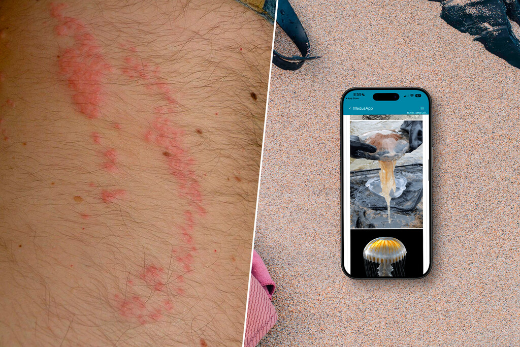 Una picadura de medusa arruinó mis vacaciones. Me prometí que no volvería a pasar y ahora siempre llevo esta app en mi iPhone 