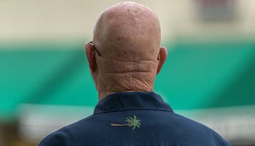 El minoxidil parecía el gran medicamento milagro contra la calvicie. Una farmacéutica financiada por Google lo acaba de superar