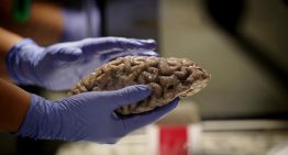 Un equipo de Sant Pau identifica un biomarcador para predecir la progresión del alzhéimer incluso en fases iniciales