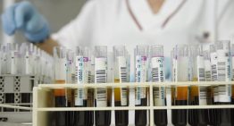 «Expedición de pesca»: una nueva vía para explorar las enfermedades neurodegenerativas