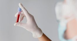 Leucemia, linfoma y mieloma múltiple: síntomas que deben ponerte en alerta de un cáncer sanguíneo