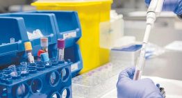 Los neurólogos urgen a preparar la sanidad pública para una «nueva era» del Alzheimer y la llegada de los primeros fármacos