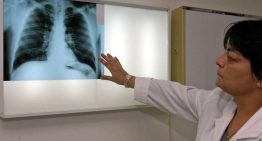 Salut integrará las imágenes médicas de centros privados en 'La Meva Salut'