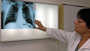 Salut integrará las imágenes médicas de centros privados en 'La Meva Salut'