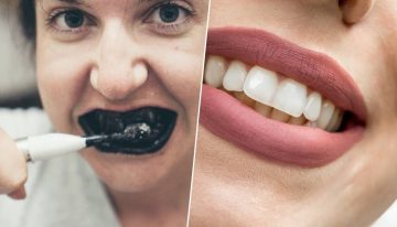 La verdad sobre la pasta de dientes con carbón activado: la peligrosa moda de TikTok que puede destrozar tu sonrisa