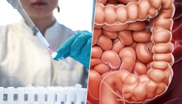 Los cánceres de colon están aumentando de forma alarmante entre los jóvenes. Tenemos un sospechoso: el sedentarismo