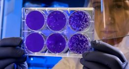 Hemos descubierto el 'botón' que usan las bacterias para escapar de los virus: es la clave para acabar con las superbacterias