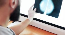 Andalucía llamará a 2.000 mujeres en una semana para detectar si hubo fallos en el cribado de cáncer de mama