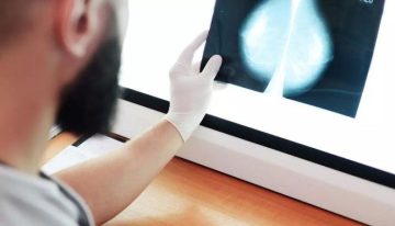 Andalucía llamará a 2.000 mujeres en una semana para detectar si hubo fallos en el cribado de cáncer de mama