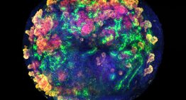 El primer trasplante de minirriñones humanos en cerdos abre una vía para no desperdiciar miles de órganos donados El primer trasplante de minirriñones humanos en cerdos abre una vía para no desperdiciar miles de órganos donados