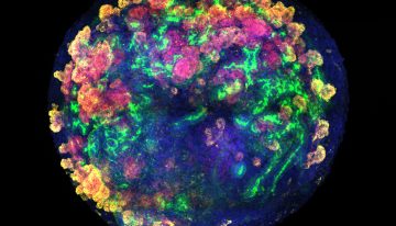 El primer trasplante de minirriñones humanos en cerdos abre una vía para no desperdiciar miles de órganos donados