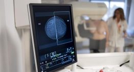 Catalunya congela la ampliación de cribados de cáncer de colon y mama por falta de Presupuestos y profesionales Catalunya congela la ampliación de cribados de cáncer de colon y mama por falta de Presupuestos y profesionales