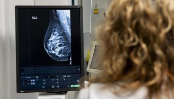 La inteligencia artificial detecta un 30% más de cánceres de mama en los cribados y tumores más avanzados