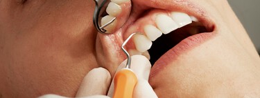 La boca está más conectada con el cáncer de lo que creíamos: han encontrado una bacteria capaz de aumentar su riesgo 