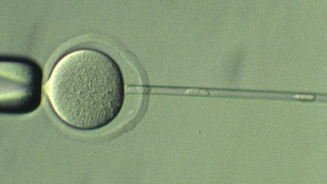 Extracción de material genético de una célula.