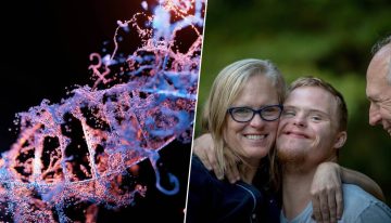 La ciencia ha logrado apagar el cromosoma extra del síndrome de Down. También ha abierto el gran debate ético sobre la edición génica