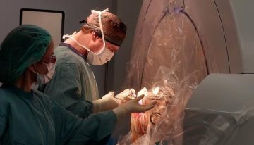 La estimulación cerebral profunda salva a un joven con síndrome de Tourette: «Tenía un alto riesgo de suicidio y vivía aislado; ahora estudia y va al cine»