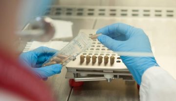 Identificados metabolitos vinculados a la microbiota intestinal que podrían ayudar a detectar la demencia años antes