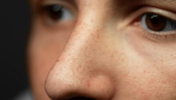 De los tratamientos antimanchas a los bioestimuladores de colágeno: estos son los 5 procedimientos estéticos más demandados