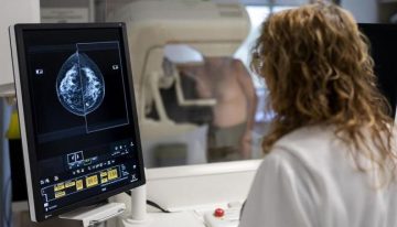 El 20% de los diagnósticos de cáncer de mama son en realidad lesiones precancerosas: «Se trata innecesariamente a un número muy alto de mujeres»