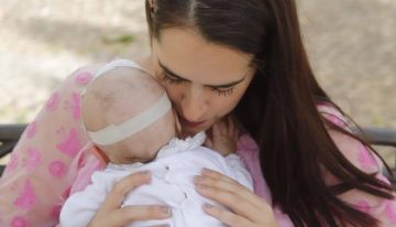 Un bebé con espina bífida severa supera una intervención fetal y regresa al hogar familiar: «Su risa lo cambia todo»